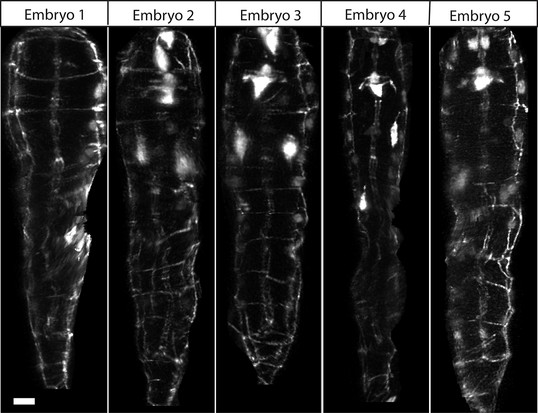 Comparison of untwisted 1.5-fold embryos after shifting