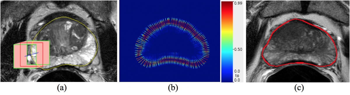 Figure 1. AlexNet patches generation and VOIs contours prediction. (a) patches along normal line, (b) probability map, (c) final contour from probability.
