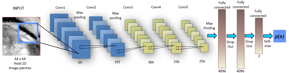Figure 2. Alex-net DCNN architecture