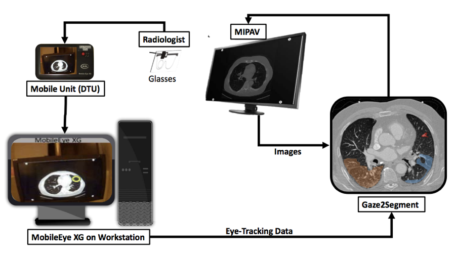 Eye Tracking System for Cancer Detection